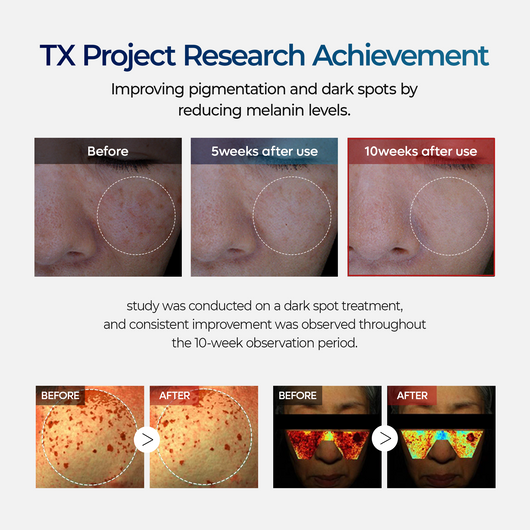 TX Ampoule Rx